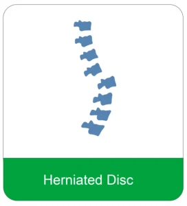 Herniated disc treatment at Graceful Pompano Beach Chiropractic Image